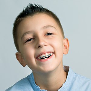Older child with phase two pediatric orthodontic appliance